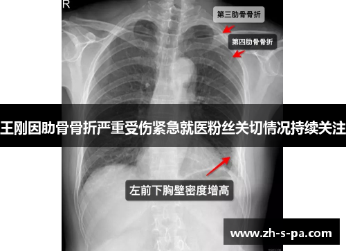 王刚因肋骨骨折严重受伤紧急就医粉丝关切情况持续关注